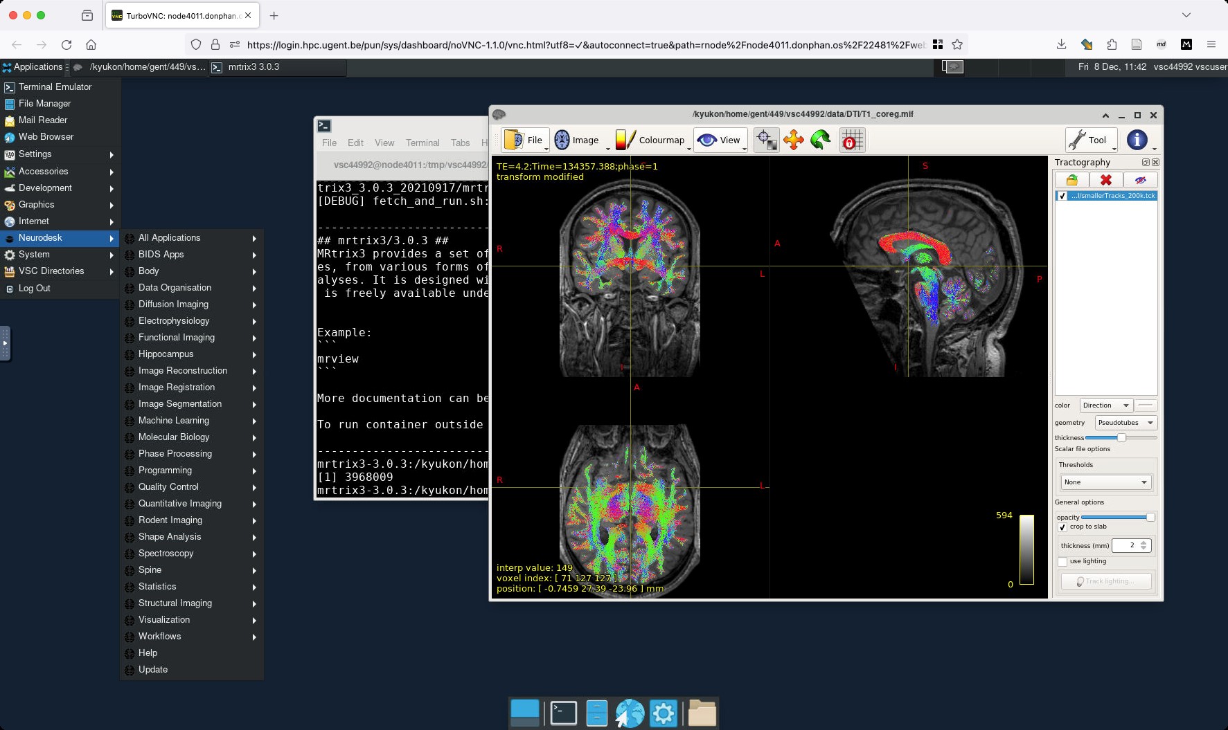 Screenshot of neuroimaging software 